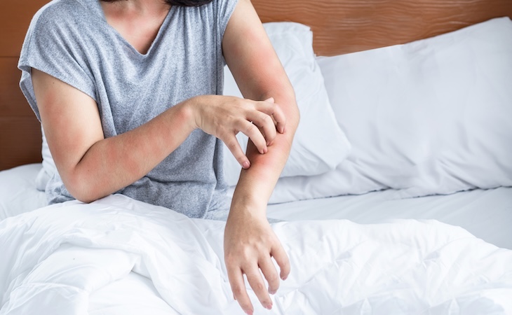 Person scratching irritated skin in bed